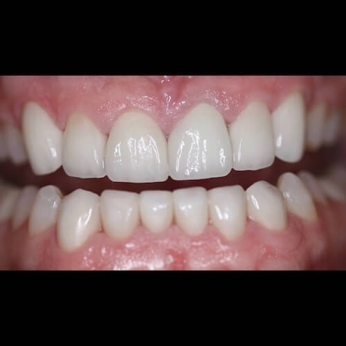 After Photo After Photo