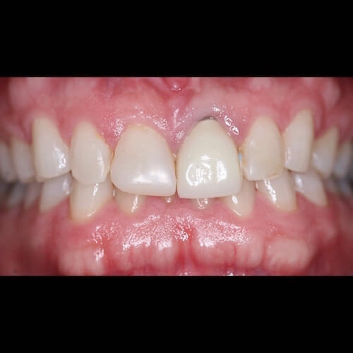 Before Photo Before Photo