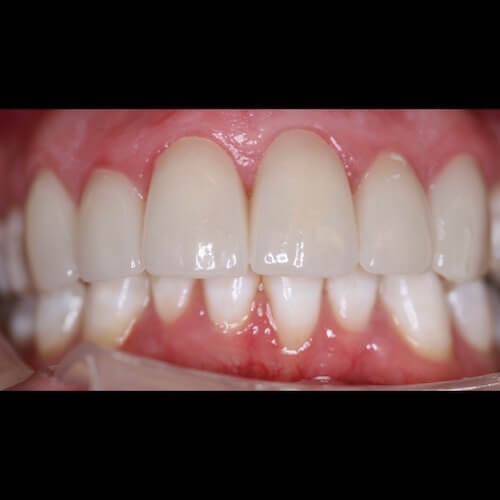 After Photo After Photo