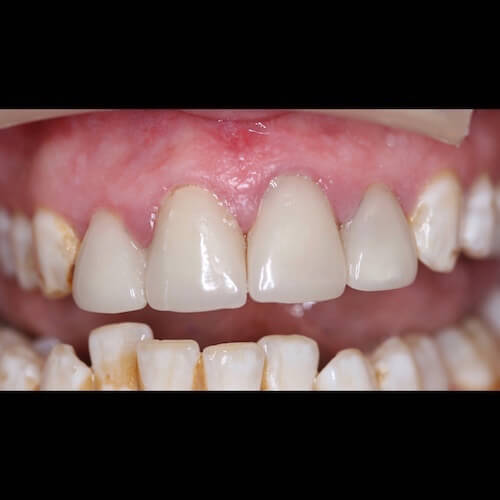 Before Photo Before Photo