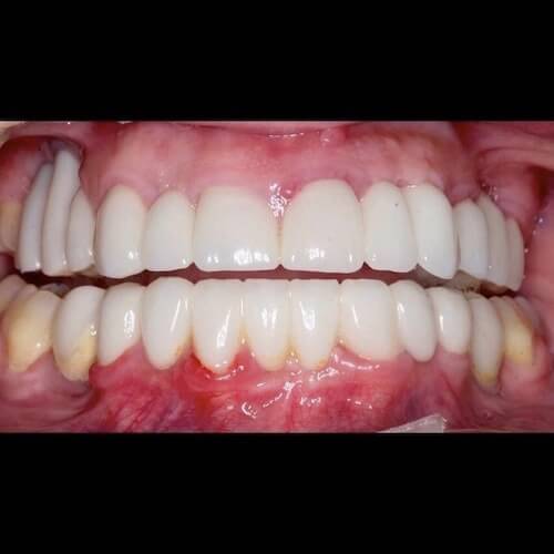 After Photo After Photo