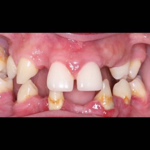 Before Photo Before Photo