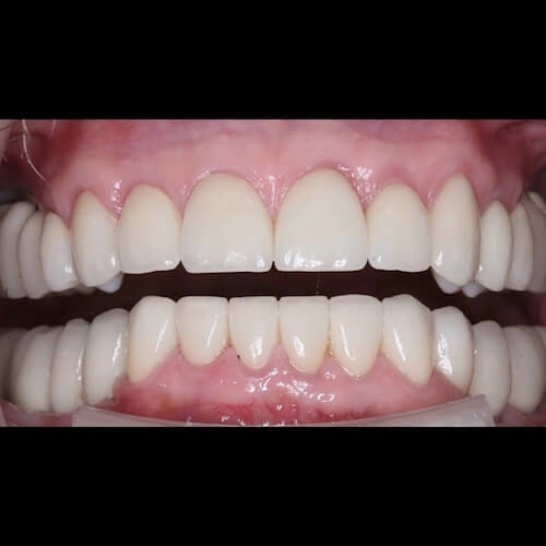 After Photo After Photo