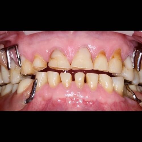 Before Photo Before Photo