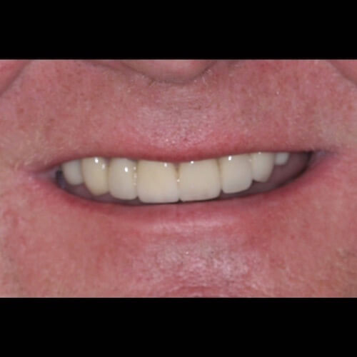 After Photo After Photo