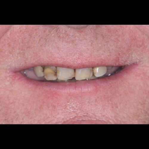 Before Photo Before Photo