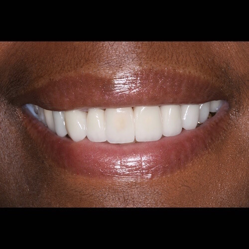 After Photo After Photo