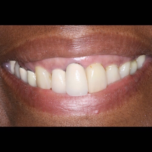 Before Photo Before Photo