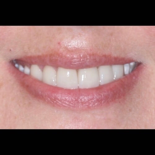 After Photo After Photo