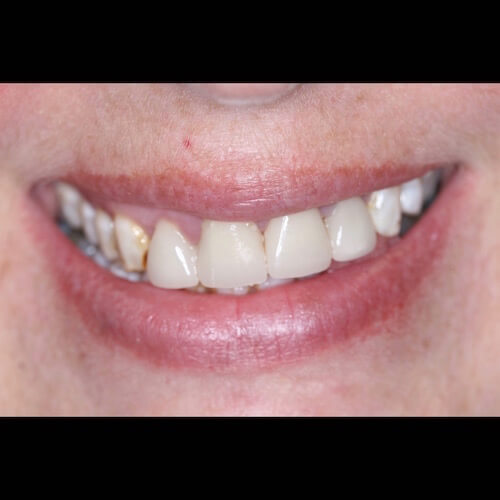 Before Photo Before Photo