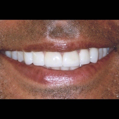 After Photo After Photo