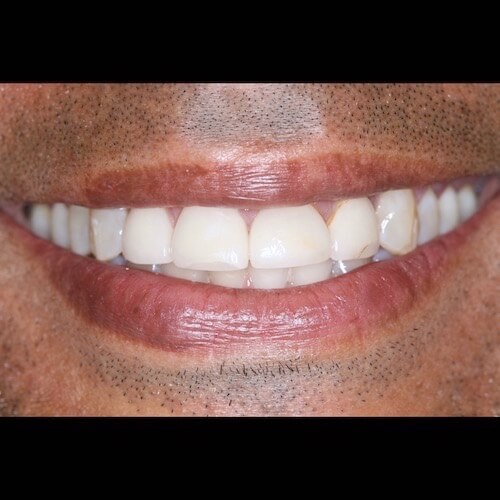 Before Photo Before Photo