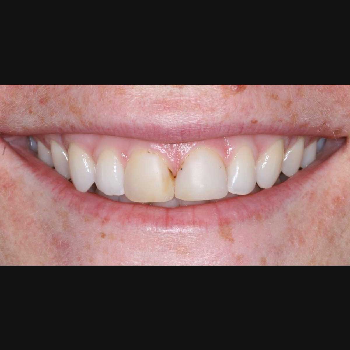 Before Photo Before Photo