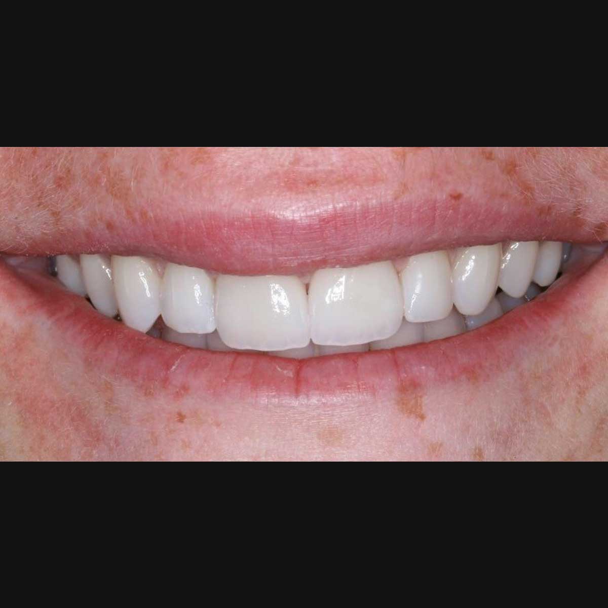 After Photo After Photo