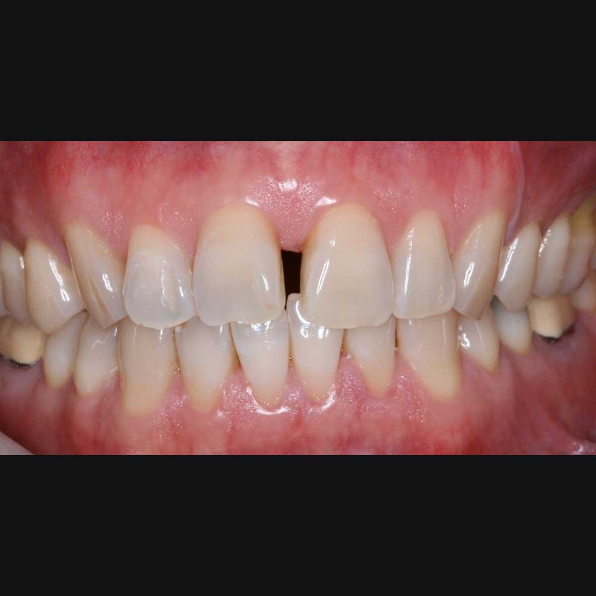 Before Photo Before Photo