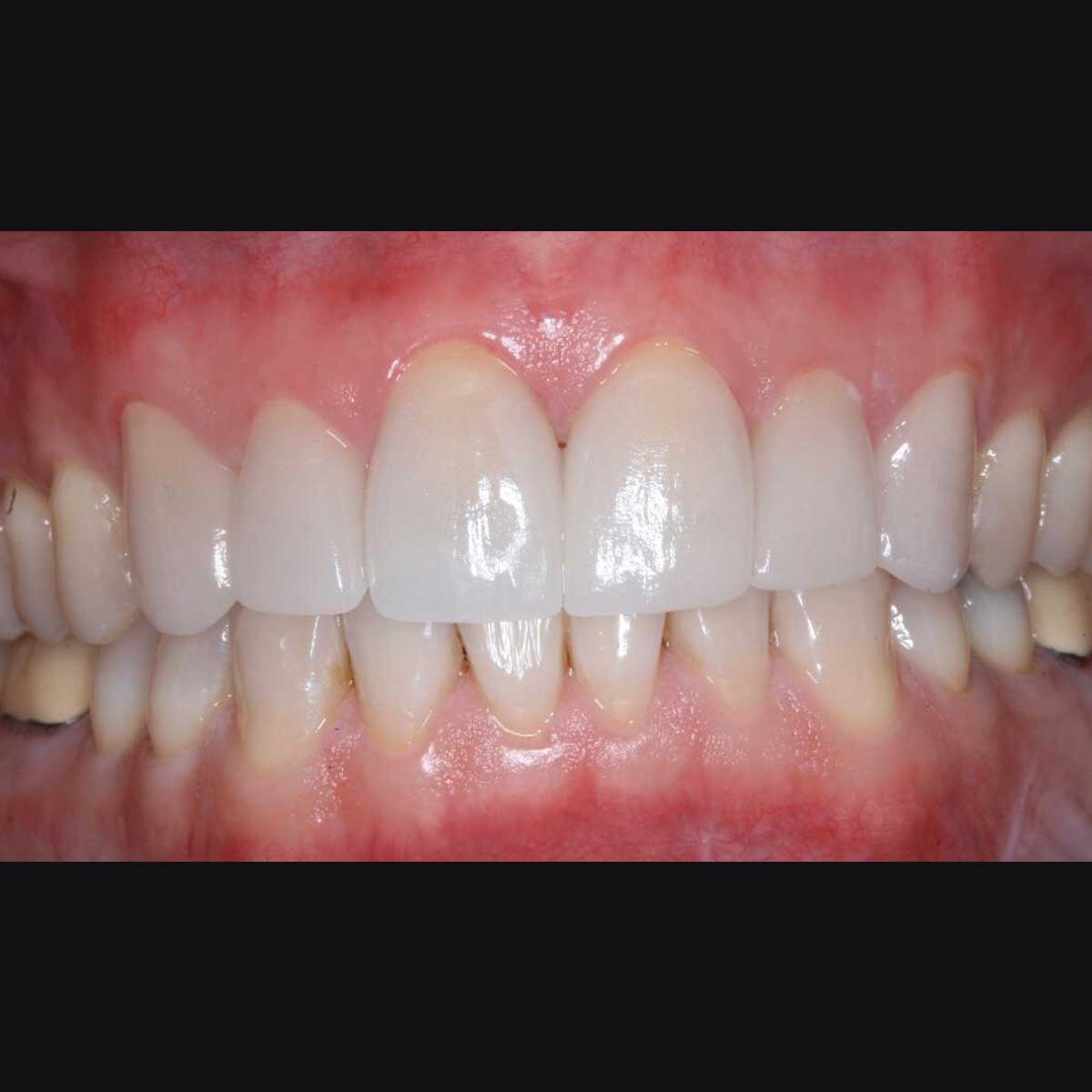 After Photo After Photo